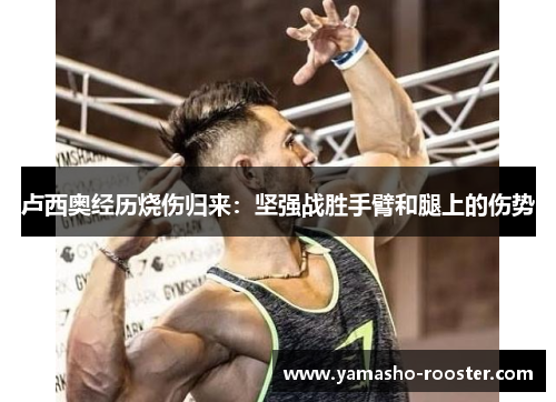 卢西奥经历烧伤归来：坚强战胜手臂和腿上的伤势